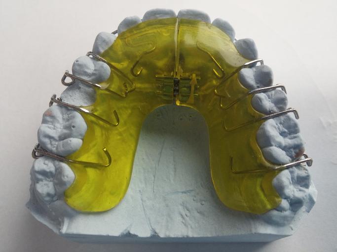 The amazing benefits of choosing porcelain dental lamination